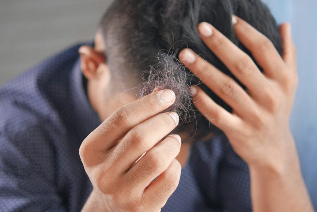 hair loss cure for men 2 scaled 1