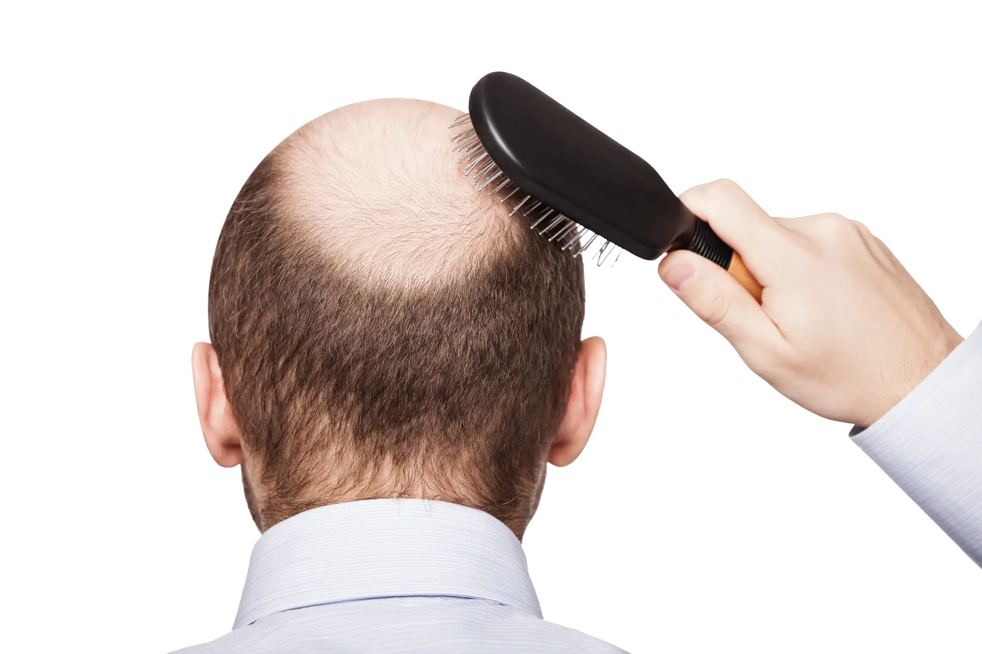 create realist image Is It Normal To Lose Hair While Showering or Brushing?