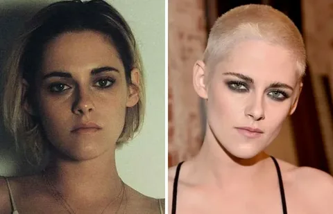 Before and After: Female Celebrities with Alopecia and Their Hair Journeys 1 Before and After Female Celebrities with Alopecia and Their Hair Journeys