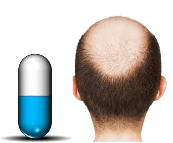 Hair Regrowth Pill: What Works, What Doesn’t & What to Know Before You Buy 1 Best Alopecia Pills for Hair Regrowth