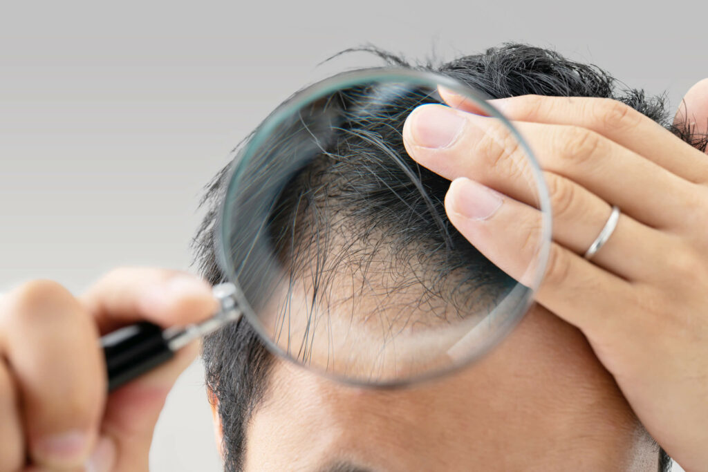 Best Hair Loss Medication Options: What Works and What Doesn’t? 1 Hair Cloning A New Beginning in Hair Restoration Is It a Reality 2