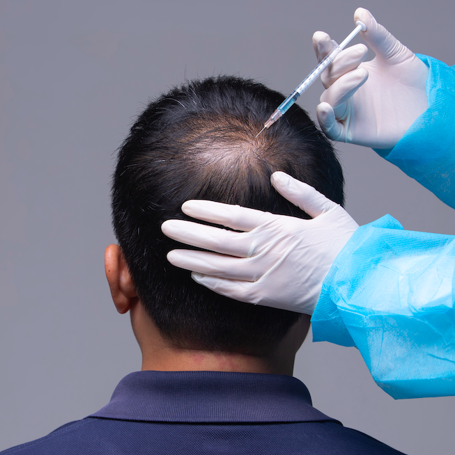 Does Medicaid Cover Hair Loss Treatment? 2 Baldness and Hairy Moles: Exploring a New Frontier in Hair Restoration