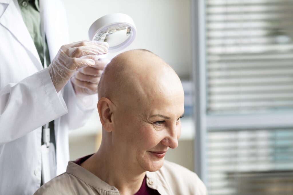 Is There a Cure for Alopecia Universalis? 3 alopiciea