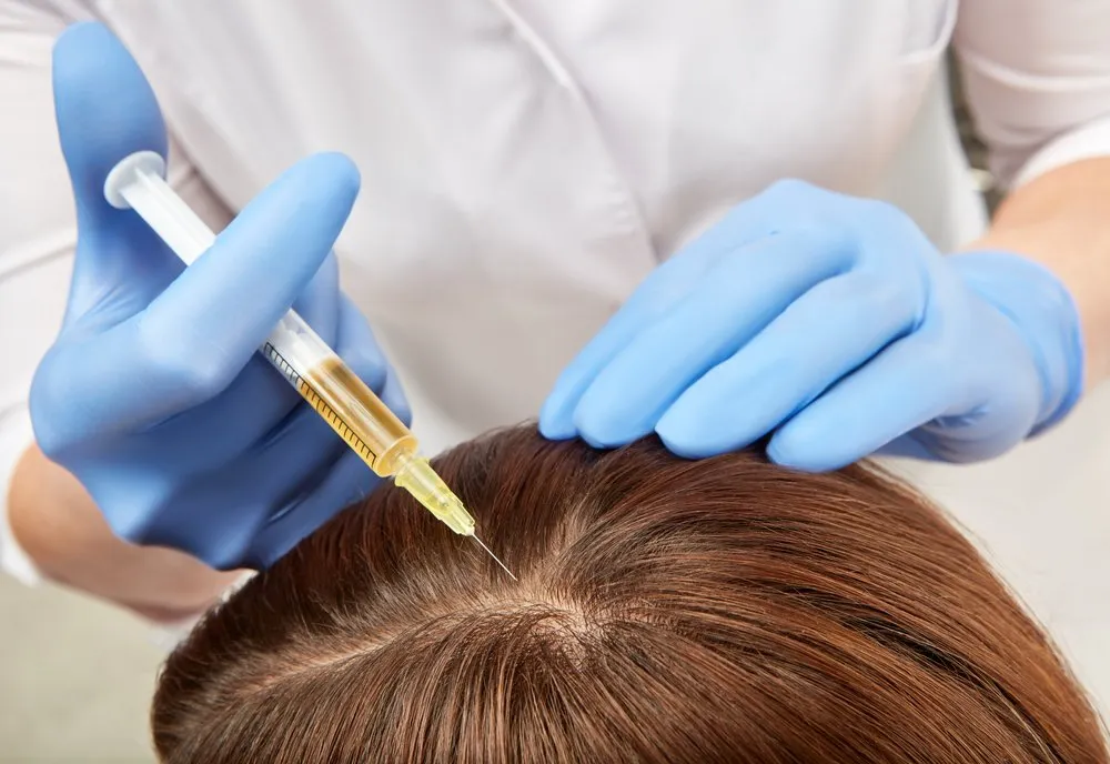 Cost of PRP for Hair Loss: What You Should Know Before Booking