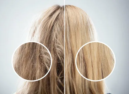 Hair Loss After Bleaching