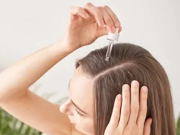 Hair Loss After Bleaching 3 Hair Loss After Bleaching