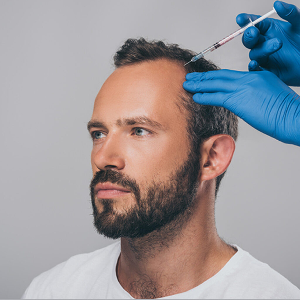 Blood Test for Hair Fall: Diagnose the Root Cause of Your Hair Loss 3 Blood Test for Hair Fall
