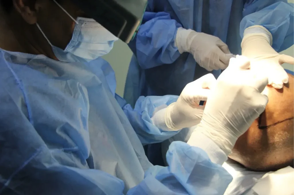 Hair Transplant Cost in Turkey: A Complete 2025 Guide to Value, Safety & Recovery 3 Hair Transplant Cost in Turkey