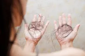 Does Bulimia Cause Hair Loss? Understanding the Connection Between Eating Disorders and Hair Health 2 Does Bulimia Cause Hair Loss