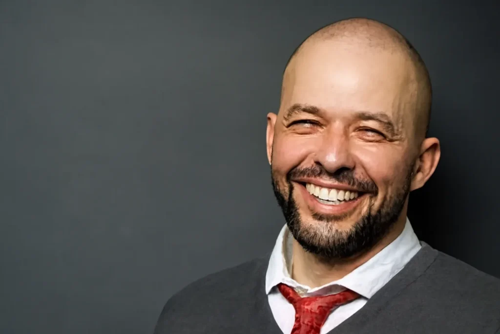 Jon Cryer Hair Loss: What Really Happened to His Hair? 1 Jon Cryer Hair Loss