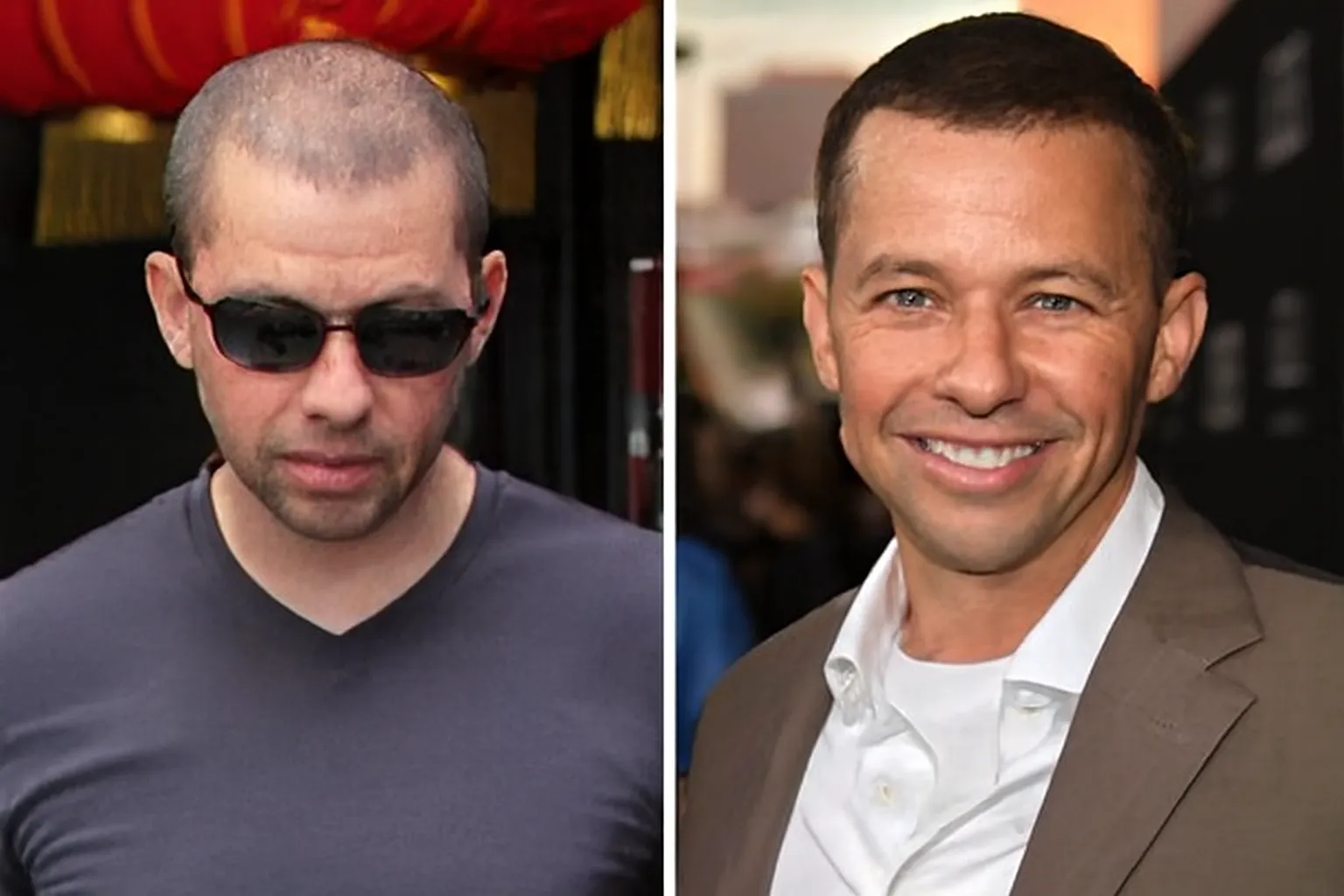 Jon Cryer Hair Loss: What Really Happened to His Hair?