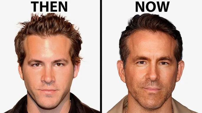 Ryan Reynolds Hair Loss: Did the Star Experience Hair Thinning or Is It Just Rumor?
